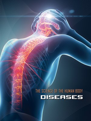 cover image of Diseases